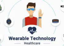 Wearable Technology